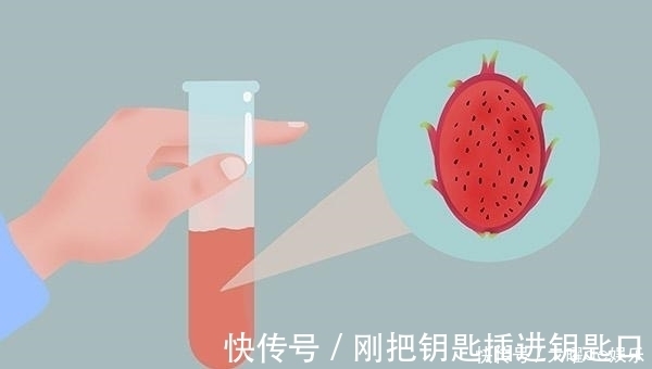 排出体外|小便时,尿液中有很多泡沫,味道还很重,是什么原因?