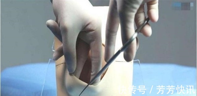 孕妇|为什么说顺产很痛?网友:光是看图就觉得很疼了!