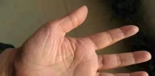 收藏|流傳幾百年的手診歌訣，面診歌訣，一看就會，果斷收藏！