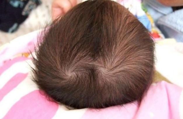 孩子头顶|为什么有的孩子头上有“2个旋”？代表什么意思，看完涨知识了