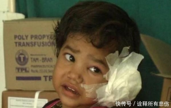 医生|岁女孩耳朵疼痛大哭, 医生从她耳朵内取出80只小虫