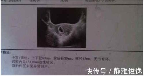 孕妇|产检时,孕妇若发现3个“信号”,或许胎宝的“秘密”藏不住了