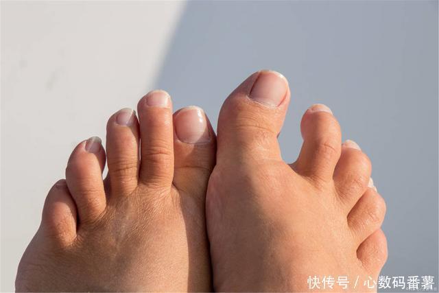 血管|血管堵塞,脚先知!医生:脚上3种“感觉”,当心血栓已“扎根”