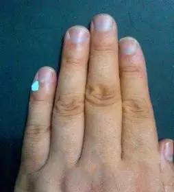 穴位|人体上居然还有“一键关机、一键清理”穴位,收藏以备不时之需!