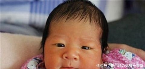 夫妻都是黄种人,却生出“黑人宝宝”,新生儿皮肤为何如此奇怪