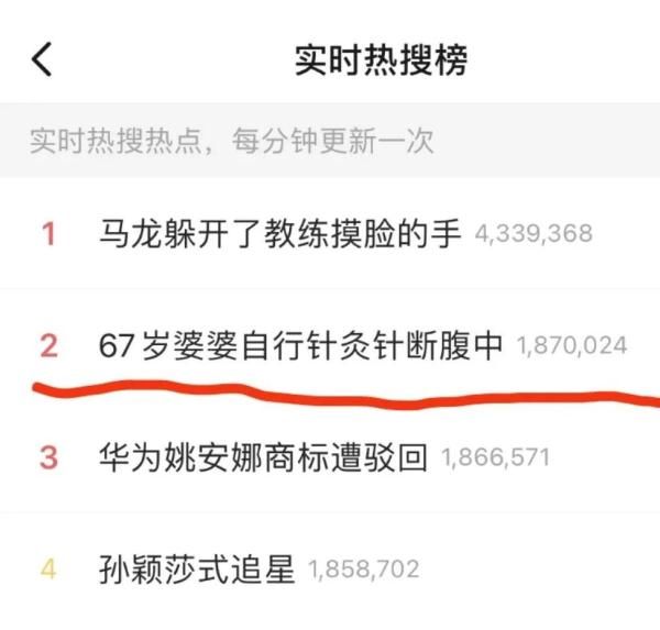 意外|阿婆自行针灸出意外，5厘米断针留在腹中