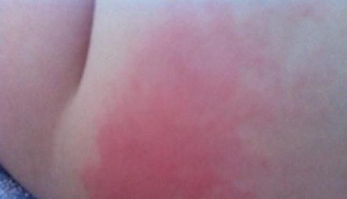 纸尿裤|姥姥怕孙女太热,把纸尿裤剪成镂空,网友:太有创意了