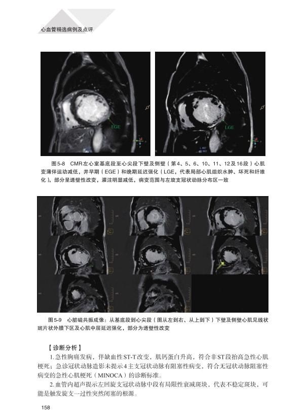 点评|凝聚经验和心血：《心血管精选病例及点评》