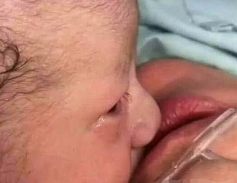 宝宝|产妇难产大出血,才出生的婴儿流泪亲吻妈妈嘴唇,所有医生都哭了