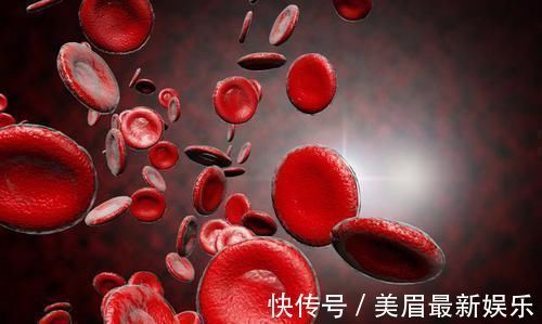 高血脂|大学教授：不想血管堵塞，做好这1点，血脂'蹭蹭'下降，远离血栓