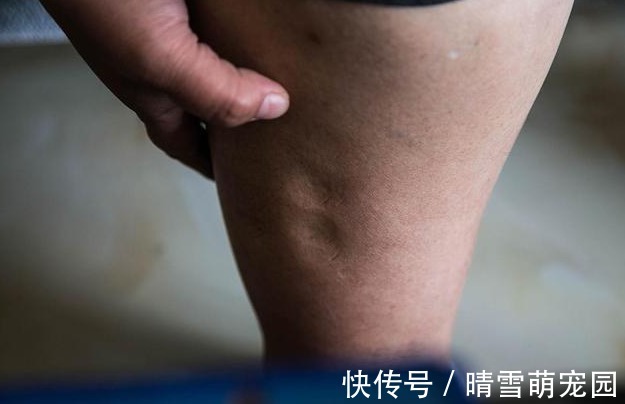 男性|男性开始衰老时，“晨起”会露出破绽，若占一半以上，别不放心上