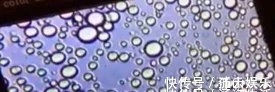 奶粉|母乳放大1000倍是什么样在显微镜下竟然是活的