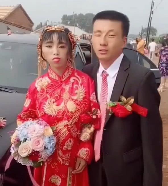 鞋拔子脸 “鞋拔子脸”新娘走红,当她亲吻新郎那一刻,网友:又相信爱情了
