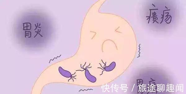 蔬菜|医生建议:想养胃的人,尽量避免吃这几种蔬菜,胃或会为你点赞