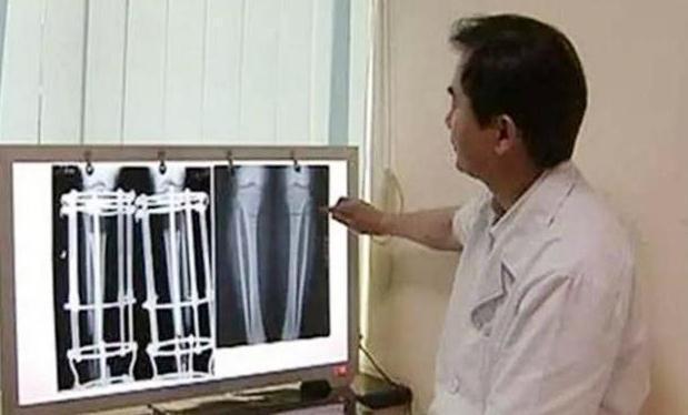 身高|身高遗传不是绝对?生长黄金期常吃6种食物,或可助孩子多长5厘米