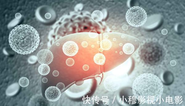 疼痛|以为是肩周炎,却不料最后查出肝癌?肩膀疼痛,究竟该如何区别?