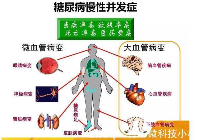 对照|世卫组织公布“最新血糖标准”，不是3.9~6.1，对照看看你高吗？