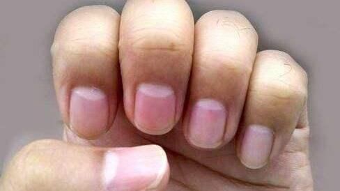 温阳|指甲月牙大小与健康的关系