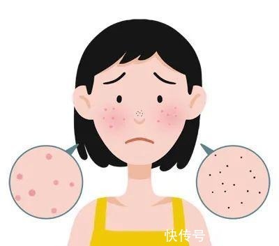 微针 医美入门干货丨常见医美项目种草与避雷_芯动医美课堂!