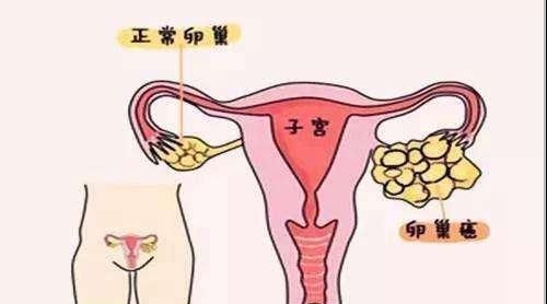 标记物|肿瘤标记物升高就是生病么？快来了解一下标记物家族
