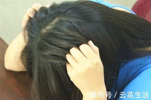 头螨|头皮一直痒，是因为剪发虫？如何去除剪发虫？一起来了解