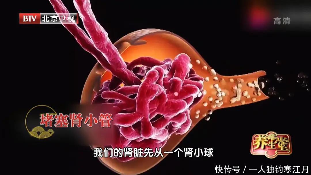 破骨细胞|久治不愈的腰背痛,可能是肿瘤在作祟3个方法,揪出致命隐患