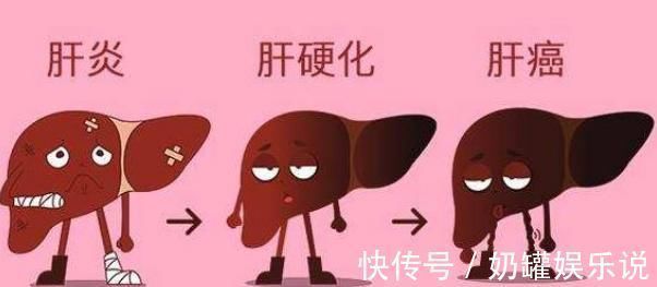 肝癌|肝脏不好,几种蔬菜买点吃,肝癌绕道走,避开肝硬化和肝炎!