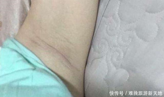 怀疑人生|孕期这些部位黑到“怀疑人生”,孕妈别担心,这是娃发育好的表现