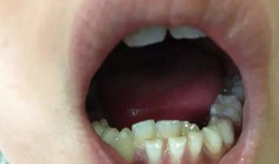 女孩|7岁的我有一个女孩,奶奶说这是祝福的表示,医生的责备感到羞愧