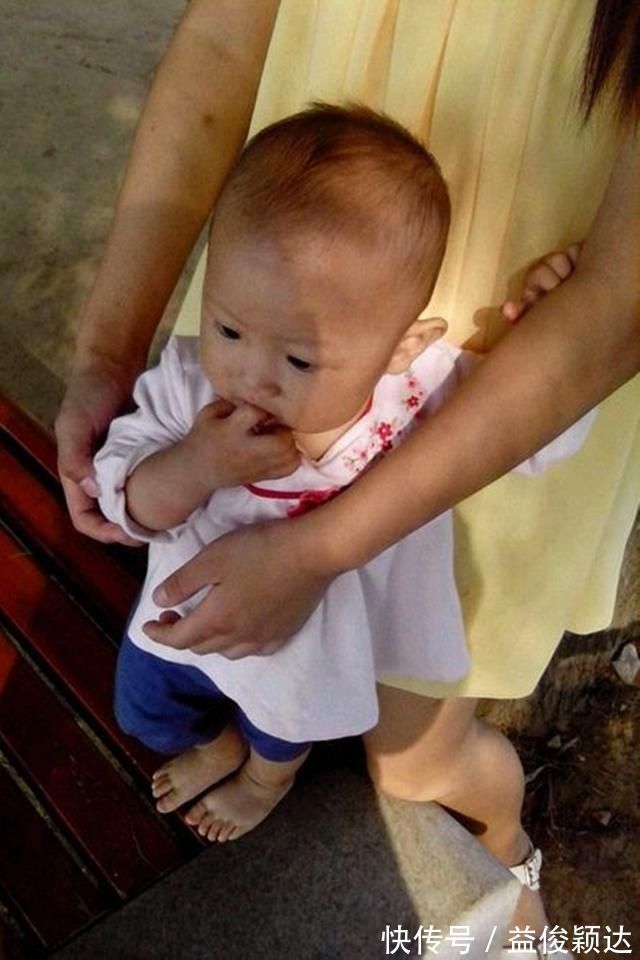 耳廓|娃的睡姿不当会影响耳朵发育,导致“招风耳”3个问题一次说清