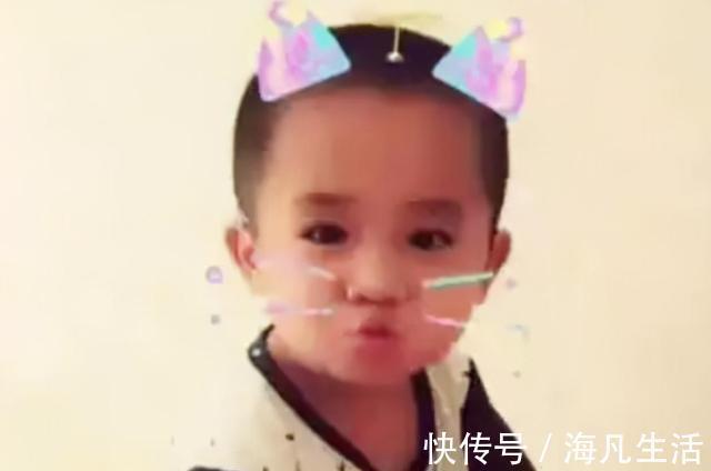 宝宝|5年前因吃奶太用力,被妈妈刮成“花脸猫”的宝宝,如今怎么样了