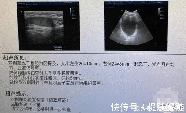 女孩|养了14年的女儿，医院一检查竟是男儿身！父母：打出生就以为是女孩