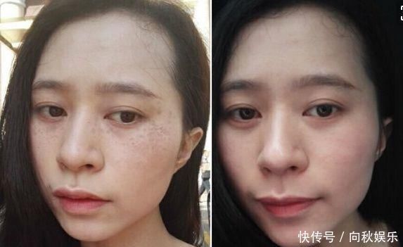 白醋遇见'它'! 睡前敷一点, 祛斑、祛皱、美白,六十岁满脸胶原蛋白