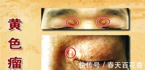 strong|三甲主任:开水里放1勺,喝上15天,血脂降了、人精神了,防血栓