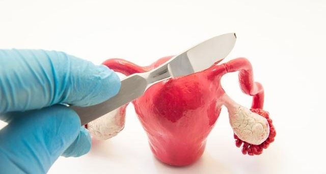 子宫|切除子宫后和正常人有何分别?还能过夫妻生活吗?给你正确答复