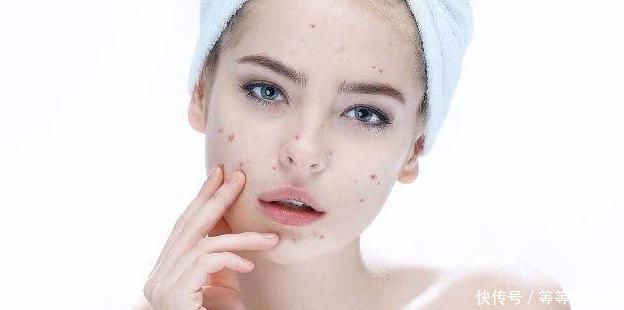 脸上长了黄褐斑,一直坚持3个方法,或许会让脸蛋光滑又干净