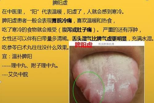 神疲乏力|脾气虚、脾阳虚，这6种脾虚，从初级到严重，你是属于哪一种？