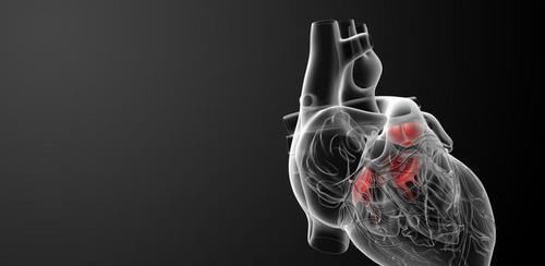 高血脂|遇到此物我从不放过,一买就是四五斤,常吃血管变年轻,血脂正常