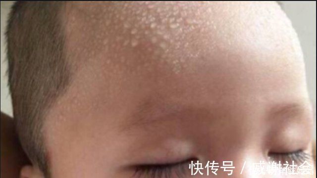 一日三餐|“脾胃虚”的宝宝,身上这2个部位经常出汗,父母早了解娃早受益