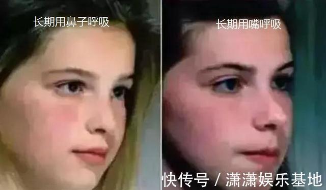 咀嚼|医生直言:5种孩子长大会变“丑”,与遗传无关,希望不是你家娃