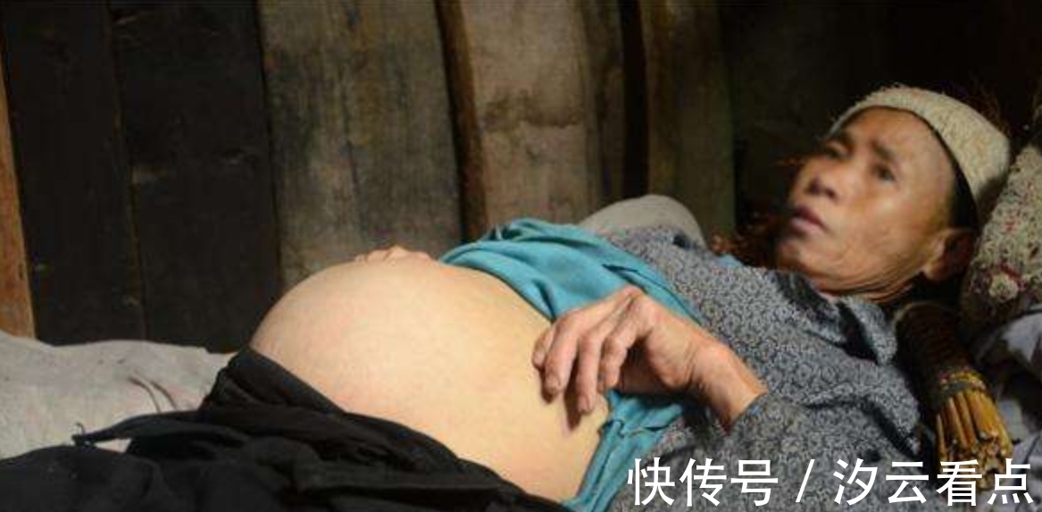 医生|90岁老人意外检查出怀孕!怀孕65年至今不知情,如今已无法生产