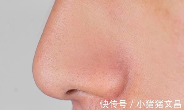 颜色|看鼻涕也能判断健康？不同颜色的鼻涕，暗示的问题也会不一样