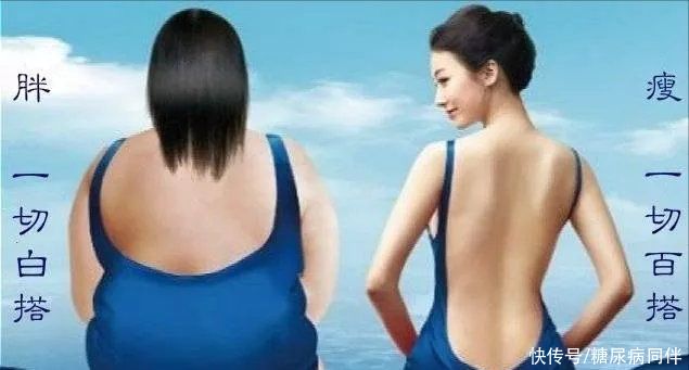 mody|糖尿病专家：凭经验，说说瘦型糖尿病人的那些事