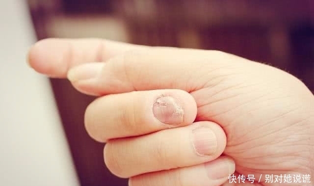 肝脏出现|手指甲为什么会出现“竖纹”?关于这4个原因,或许你还不清楚
