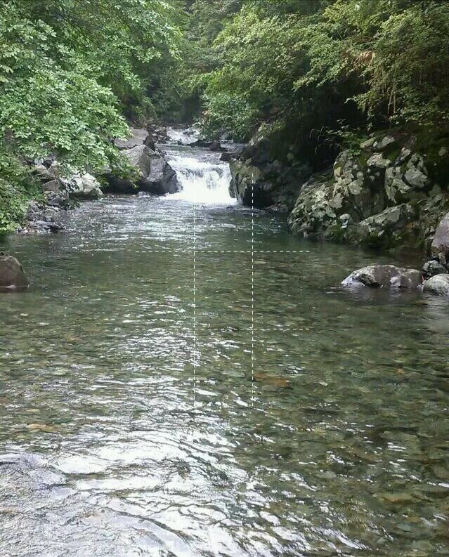 鼻塞|太可怕!蚂蟥在男孩鼻腔内吸血半个月,为何一点感觉都没有?