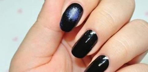 小孩|孕期若常做3件事,或会增加胎儿长胎记的概率,孕妈不妨了解