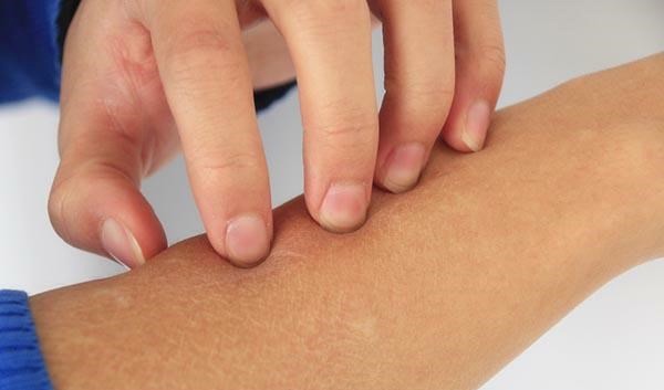 肝癌|医生提醒大家,得了癌症,皮肤是会给出信号的,4点异常较为明显