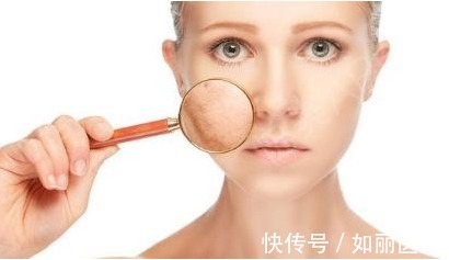 改善 你做的医美项目做对了吗?干货整理!