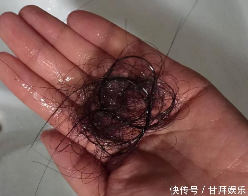 洗头|多久洗一次头胎是最正常的呢?头发需要“天天洗”吗?