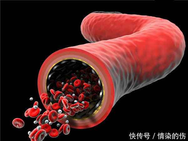 因素|你了解心脑血管疾病吗